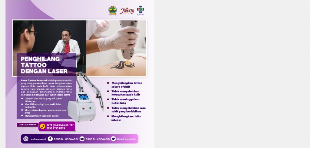 Penghilang Tattoo dengan Laser